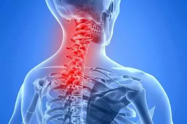 best hospital for cervical spondylitis treatment in narsinghpur, best doctor for cervical spondylitis treatmen in narsinghpur, cost of cervical spondylitis treatmen in narsinghpur