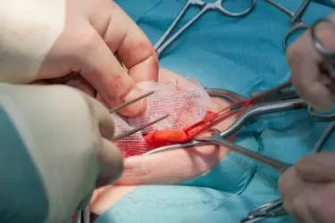 best hospital for hernia repair surgery in Narsinghpur, best doctor for hernia treatment in Narsinghpur, cost of hernia surgery in Narsinghpur