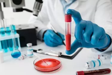best pathology lab in narsinghpur, best lab for blood test in narsinghpur, best nabl lab in narsinghpur