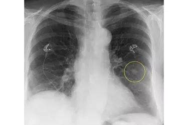 best hospital for digital x-ray test in narsinghpur, best doctor for digital x-ray test in narsinghpur, cost of digital x-ray test in narsinghpur